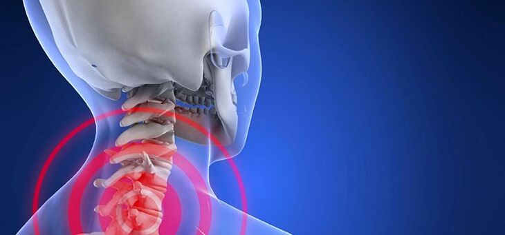 Osteochondrosis of cervical regions