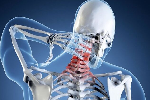 Osteochondrosis of cervical regions