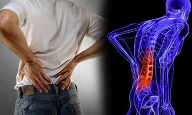 Reasons for the development of lumbar osteochondrose